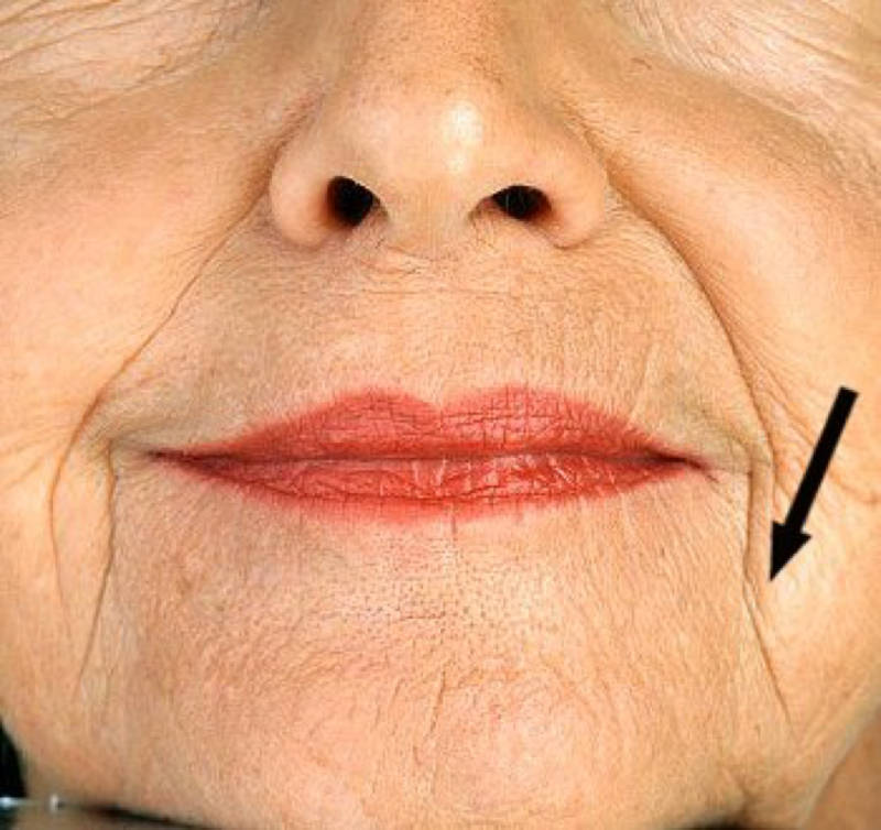 z2yzrco5ud-old-woman-lipstick-ritides.jpg